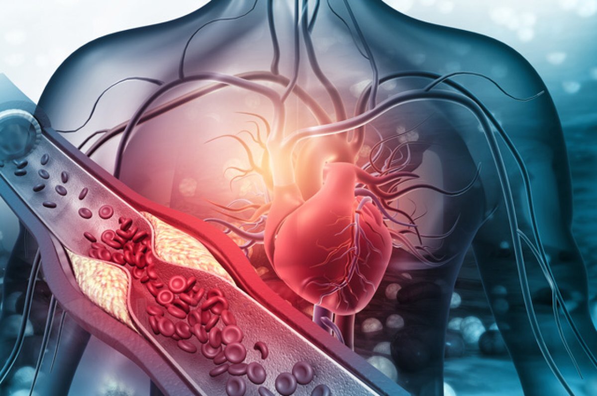    Холестерин не пройдет.