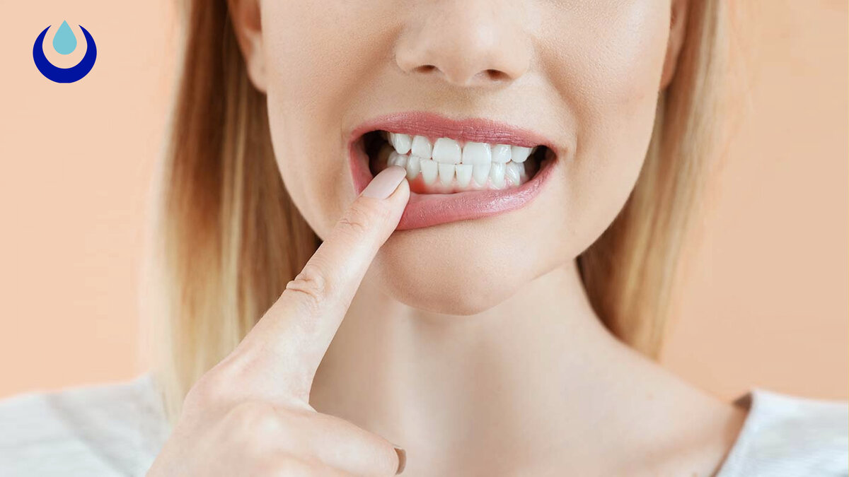 Уход за полостью рта с помощью перекиси водорода | Перекись Live | Дзен