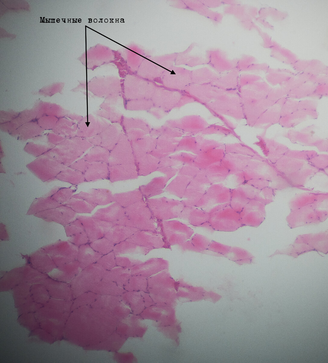 Мышечные волокна (мясо)