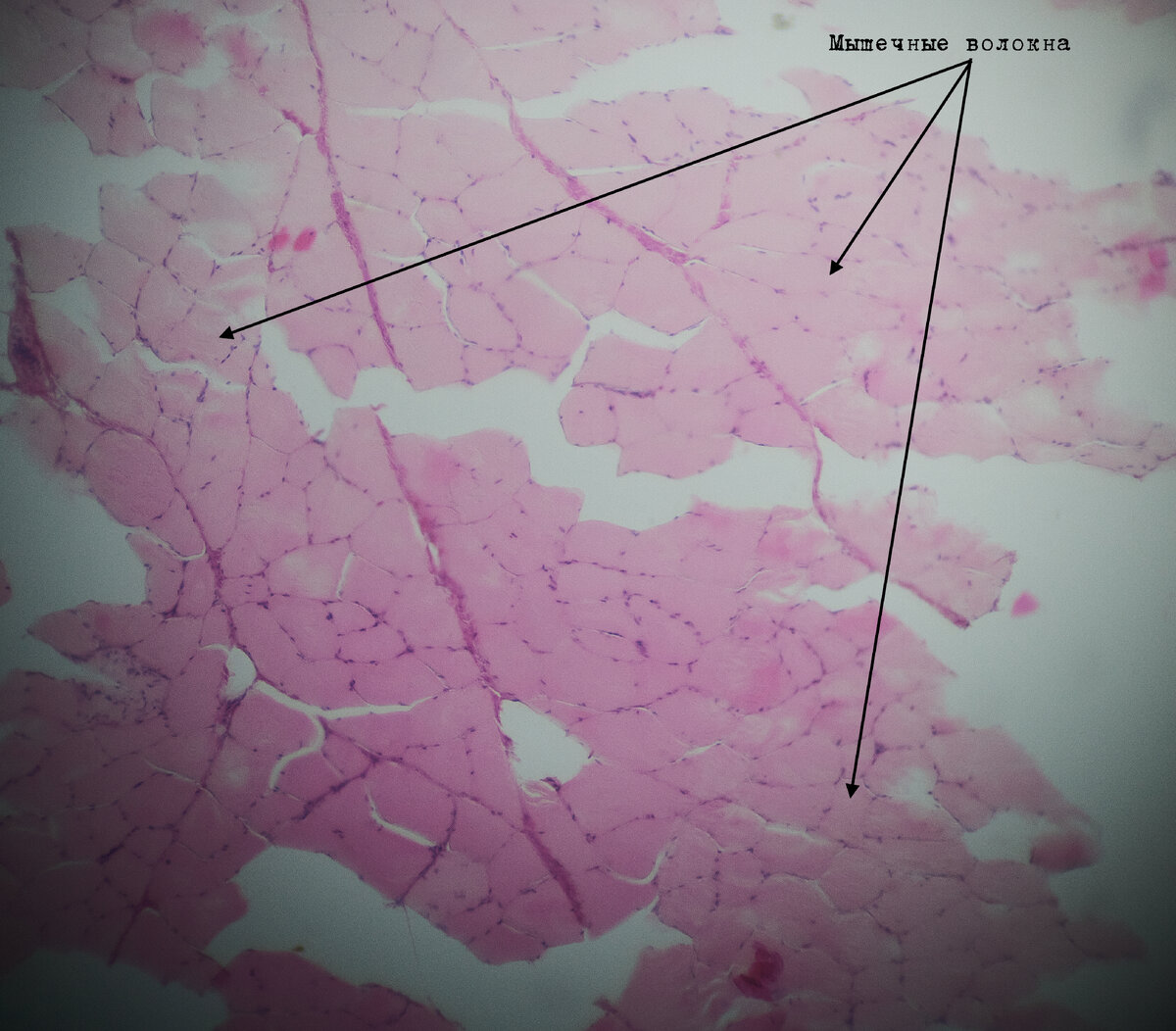 Мышечные волокна (мясо)