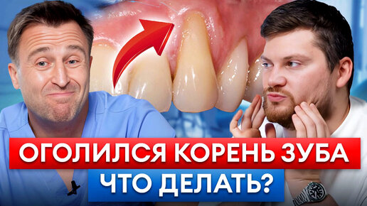 Download Video: Что делать, если шейка зуба ОГОЛИЛАСЬ? 8 факторов рецессии десны