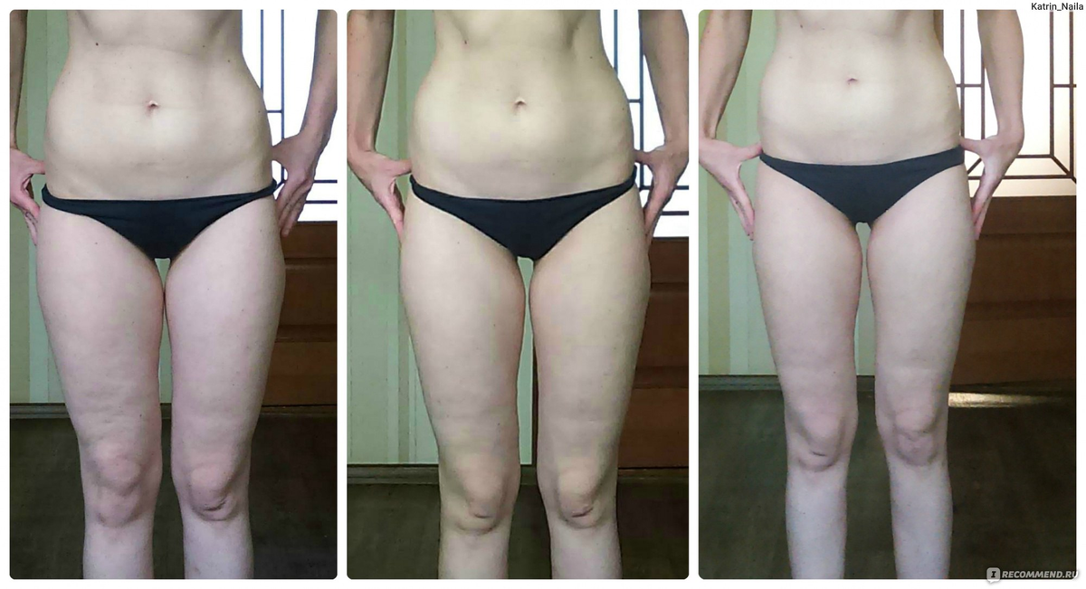 Почему отек после тренировки. Лимфодренажный массаж тела до и после. Лимфодренажный массаж живота до и после. Лимфодренажный массаж тела от отеков. Бодифлекс живот до и после.