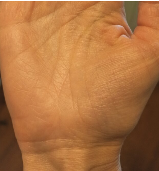 Фото руки подписчицы из комментариев к моим статьям. 