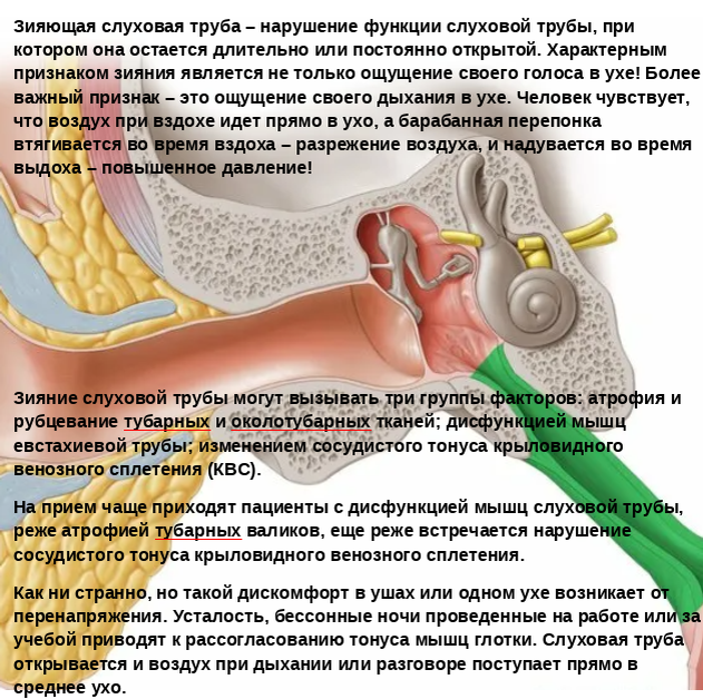 Заболевания евстахиевой трубы: симптомы, лечение, профилактика