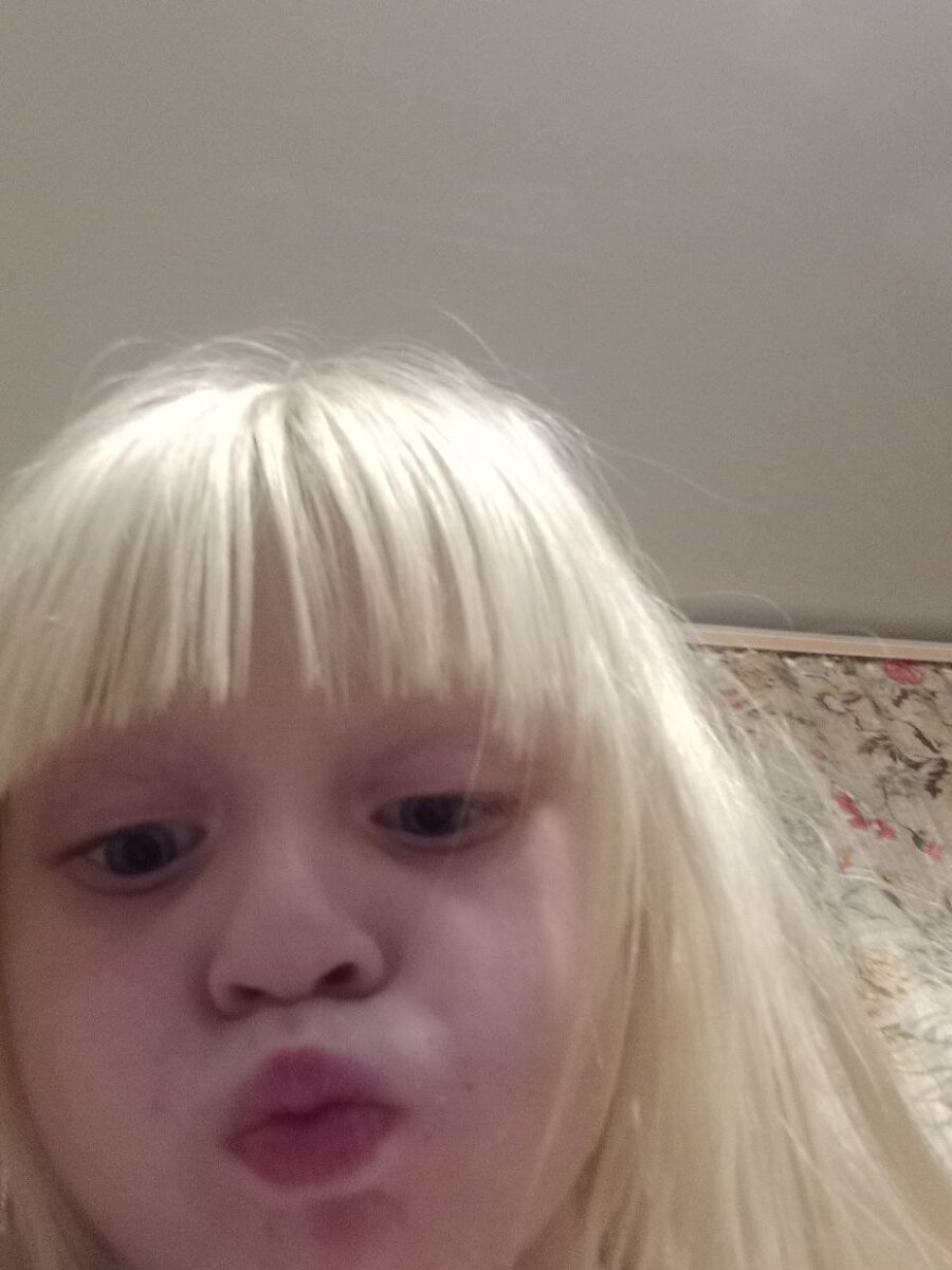 😘