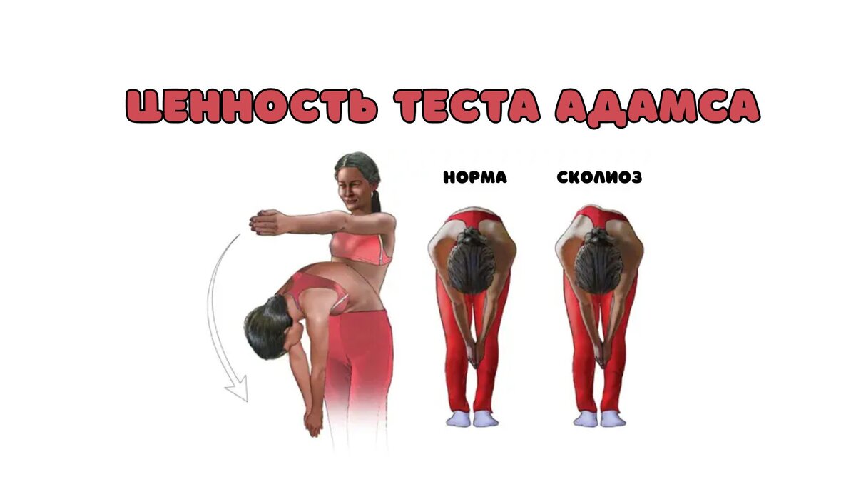 Ценность теста Адамса