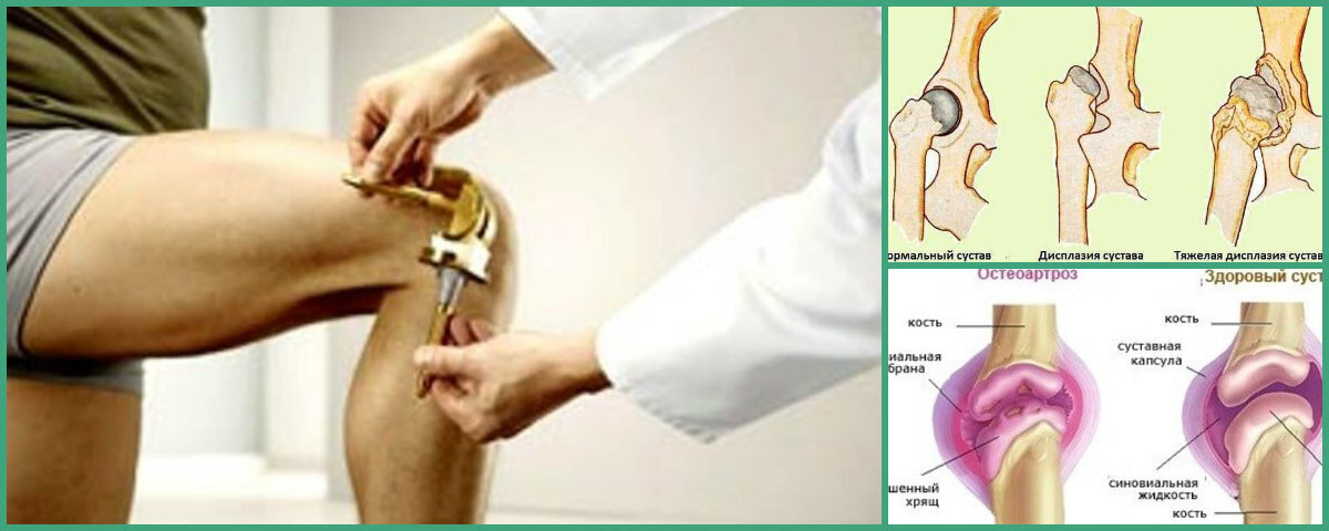 Лучше не примеряйте, вам всё равно это не к лицу. Фото из интернета.