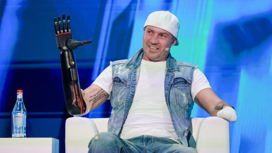    Костомаров озвучил прозвище, которое придумал ему сын после протезирования Роман Захаров