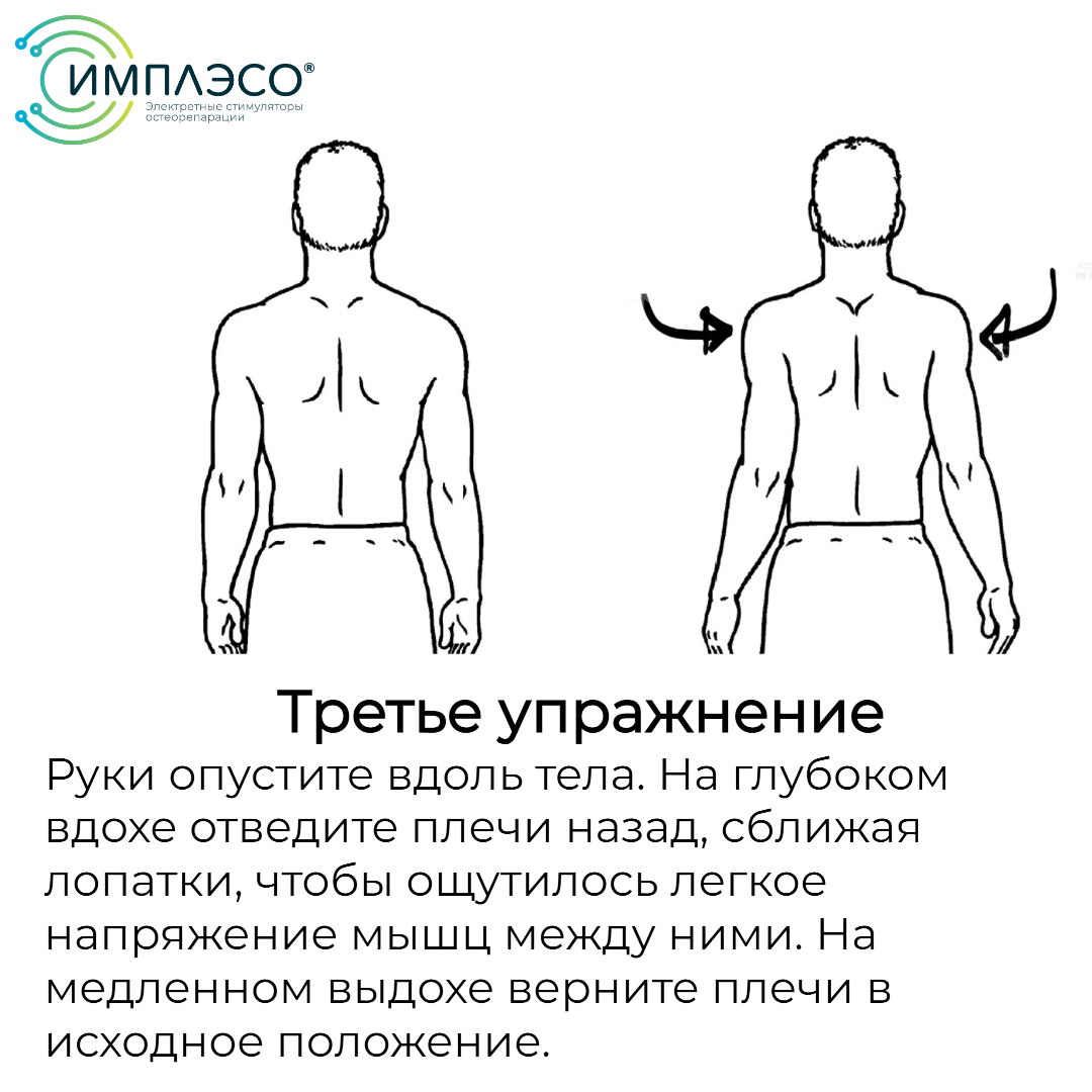 Схема установки банок на спину при остеохондрозе