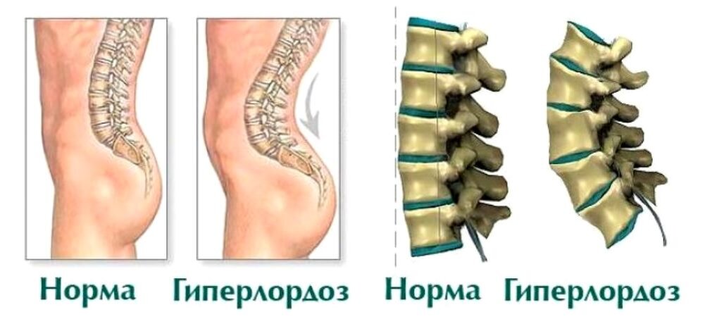 Вопрос - ответ