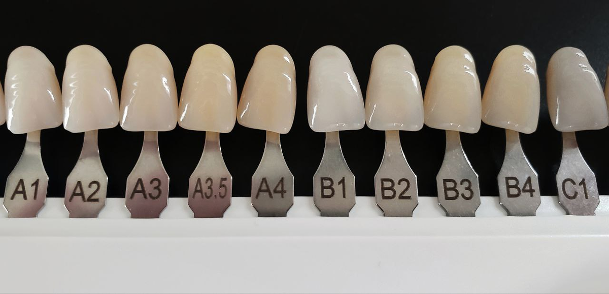 Пациент подбирает оттенки накладок вместе с ортопедом.