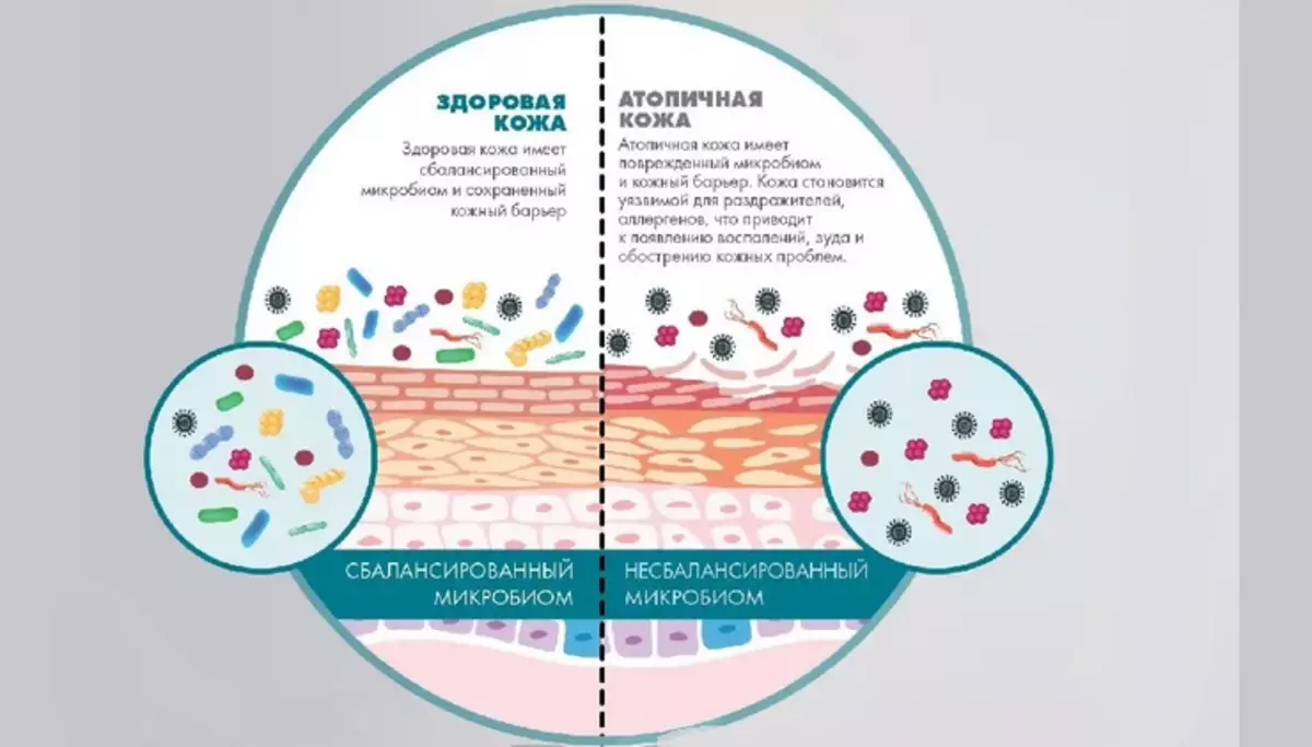 Состав микробиома. Микробиом кожи человека. Нормальная микрофлора кожи. Микрофлора кожи здорового человека. Микроорганизмы нормальной микрофлоры кожи.