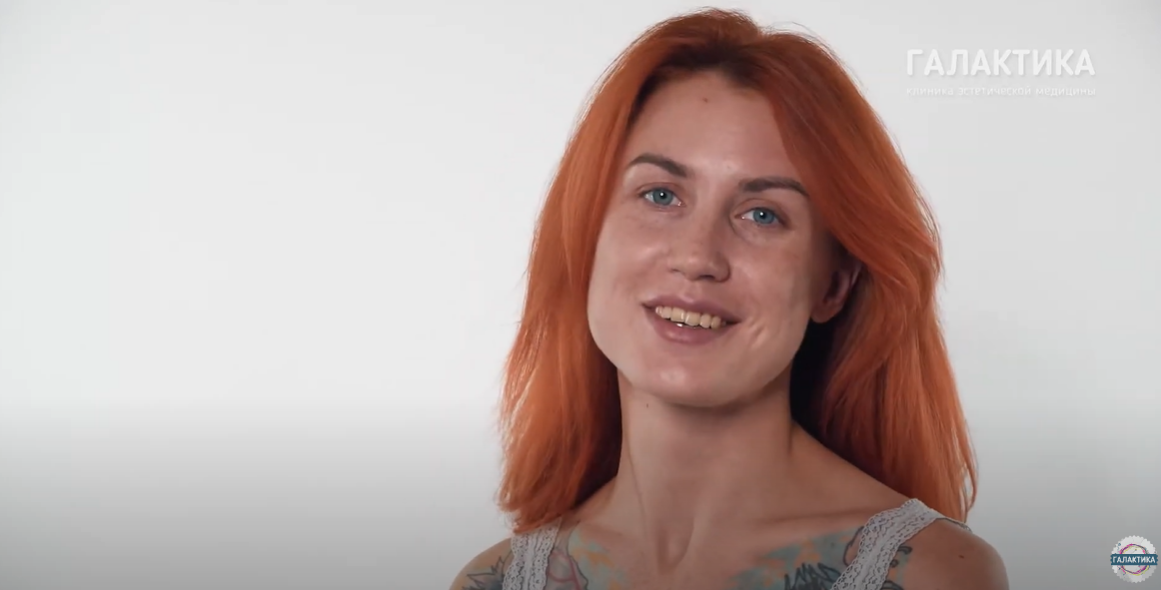 Пациентка Елена