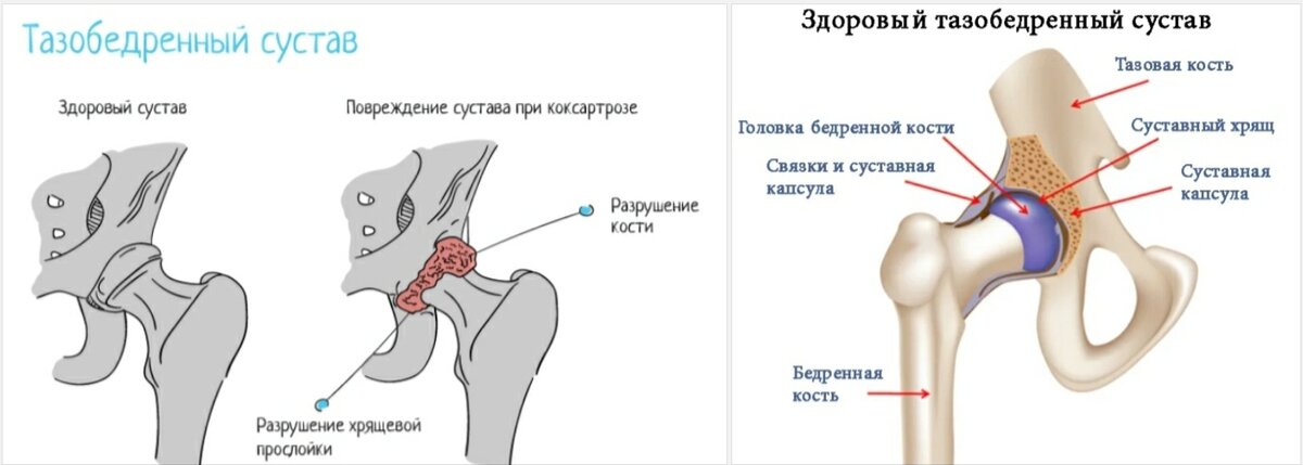 Почему появляются боли?