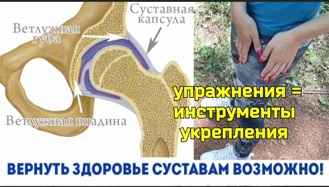 народные средства от боли в суставах. что делать если болят суставы. стадии развития артрита. сустав колена. суставы.