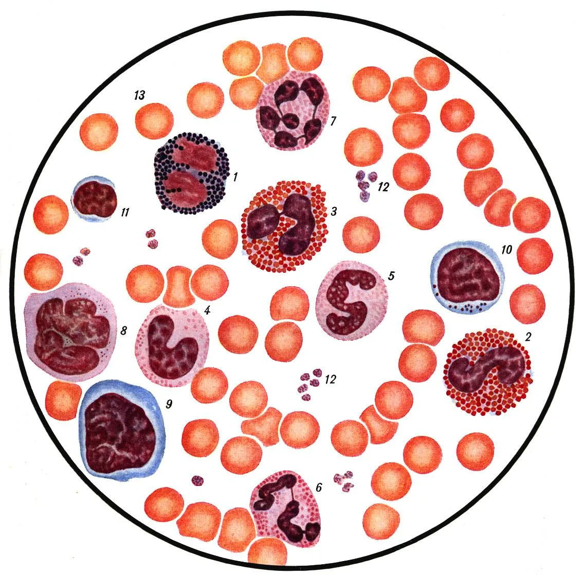 Здоровая кровь содержит определенный процент лейкоцитов (они же белые клетки крови), которые, как часть иммунной системы организма, помогают организму бороться с инфекцией.-2