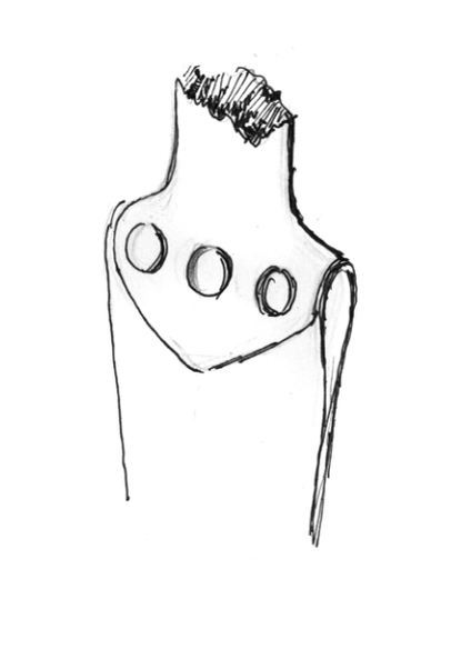 Крепление рукояти и навершия к кинжалу без хвостовика, по Констаниди-Сивириди и др., 2023