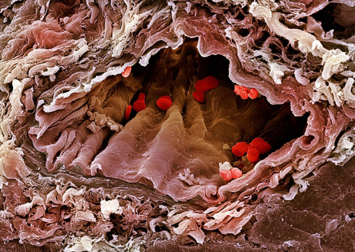 Кровеносный сосуд в сканирующем электронном микроскопе: завораживающее зрелище!