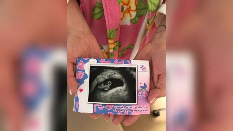    В Оренбургском перинатальном центре будущим мамам результат УЗИ вручают в открытке Андрей Севостьянов