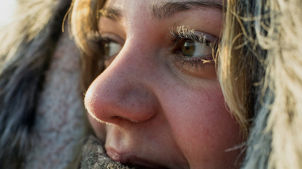 Сильное слезоточение на морозе говорит о проблемах с глазами - Российская газета