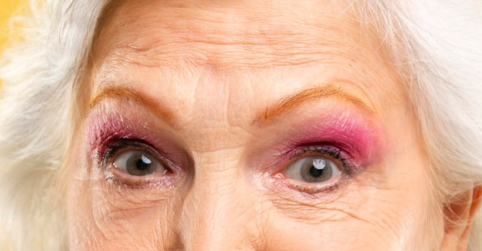 Волосы и брови контрастируют