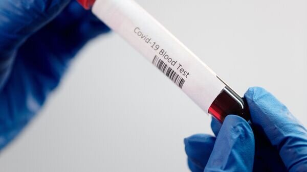    CC0 / Рexels / Edward Jenner /