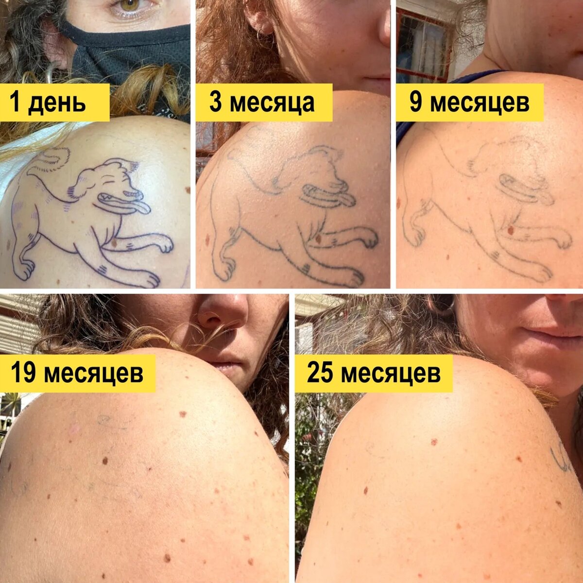 Фотографии и подписи к ним взяты с официального сайта Ephemeral. Видим, что срок полного исчезновения татуировки указан как 25 месяцев, однако, это – корректировка, которая произошла после того, как скандал с неисчезновением исчезающих татуировок начал набирать силу.  📷
