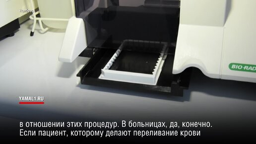 «Контроль очень жесткий»: названы места с высокими рисками заражения ВИЧ-инфекцией