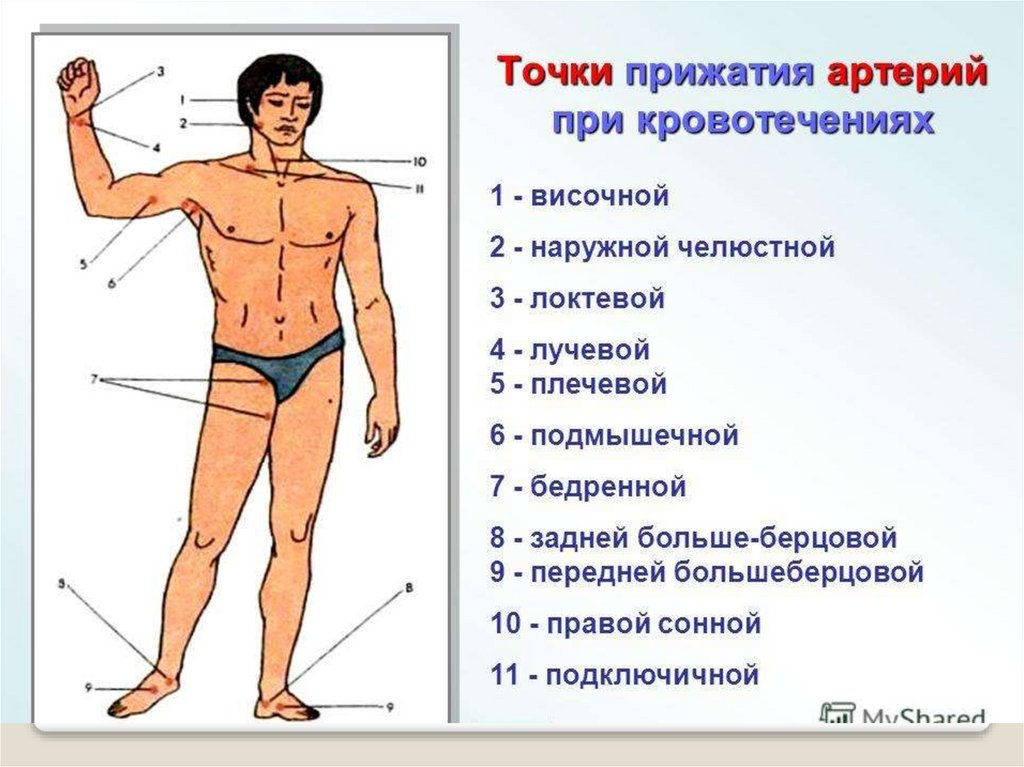 Презентация виды кровотечений и способы их остановки презентация