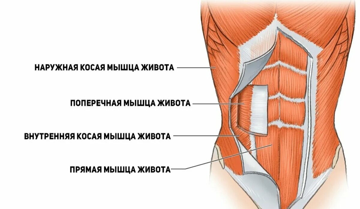 Грыжи спигелевой линии. Грыжи спигелевой линии. Спигелиевая линия живота это. Грыжа спигелиевой линии живота анатомия. Спигелиевая линия грыжа.