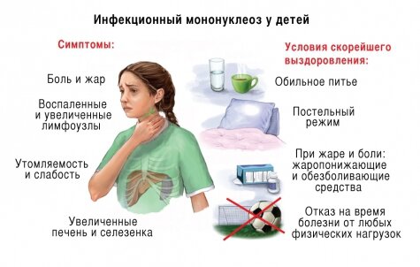 Мононуклеоз: симптомы, лечение