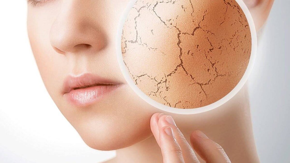 Шелушение кожи на лице: причины и как с этим бороться | Eucerin