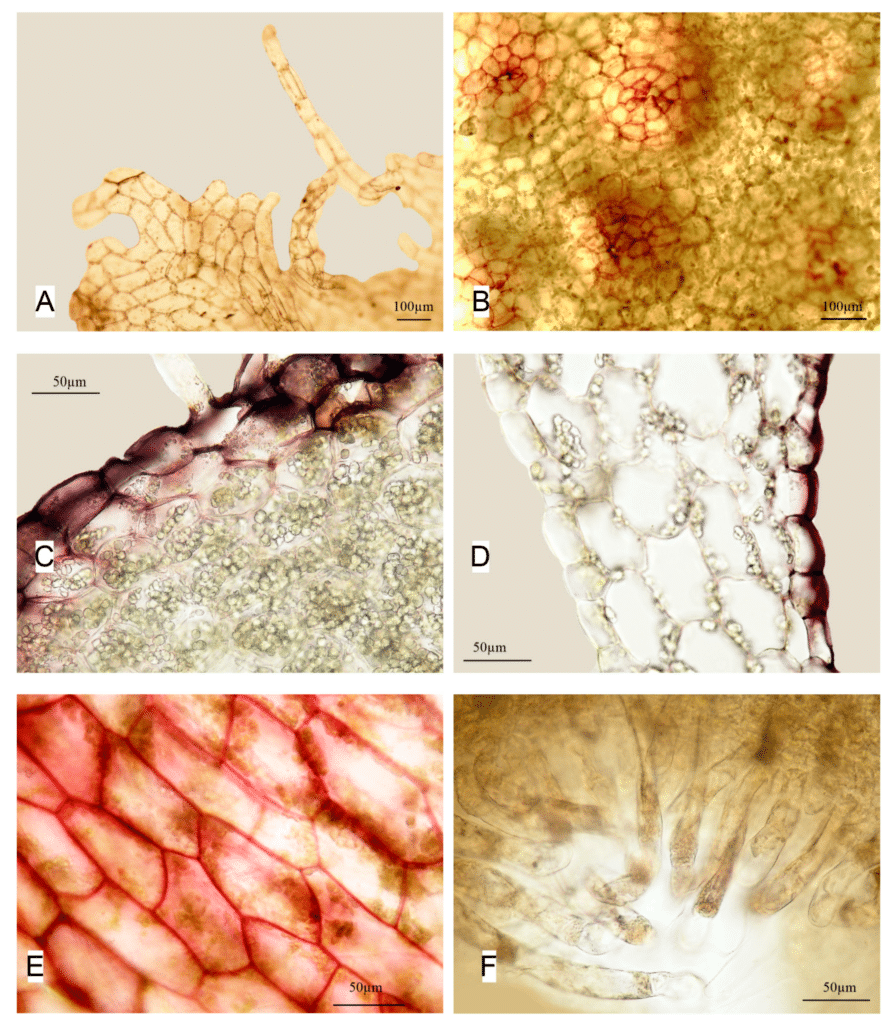    Препараты клеточного строения разных участков Apopellia alpicola / © Пресс-служба КНЦ РАН