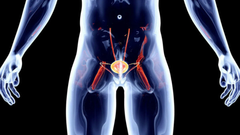     Рак простаты. clinica-urology.ru