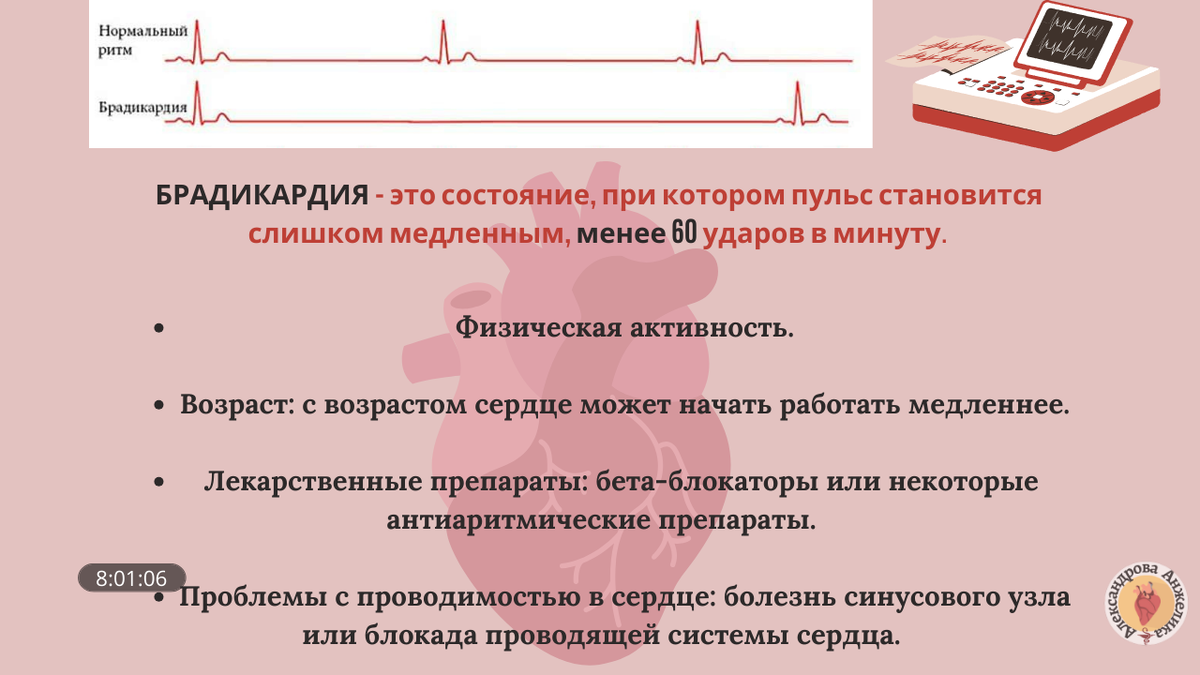 Почему возникают колебания сердечного ритма? | Надежда для сердца | Дзен