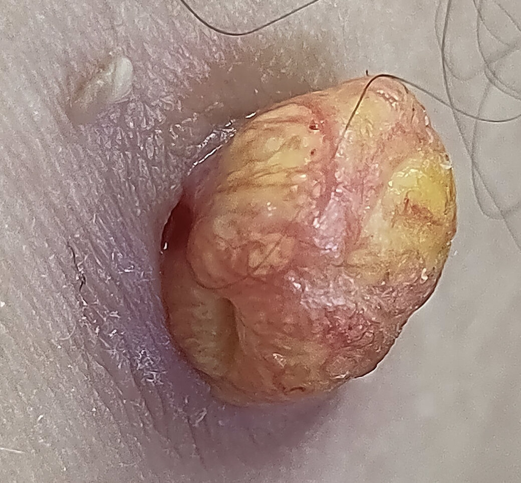 источник фото wikipedia