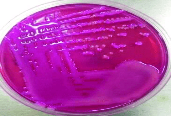 Стафилококк хаемолитикус у мужчин. Стафилококк гемолитикус. Staphylococcus haemolyticus 10 6. Staphylococcus haemolyticus у мужчин.