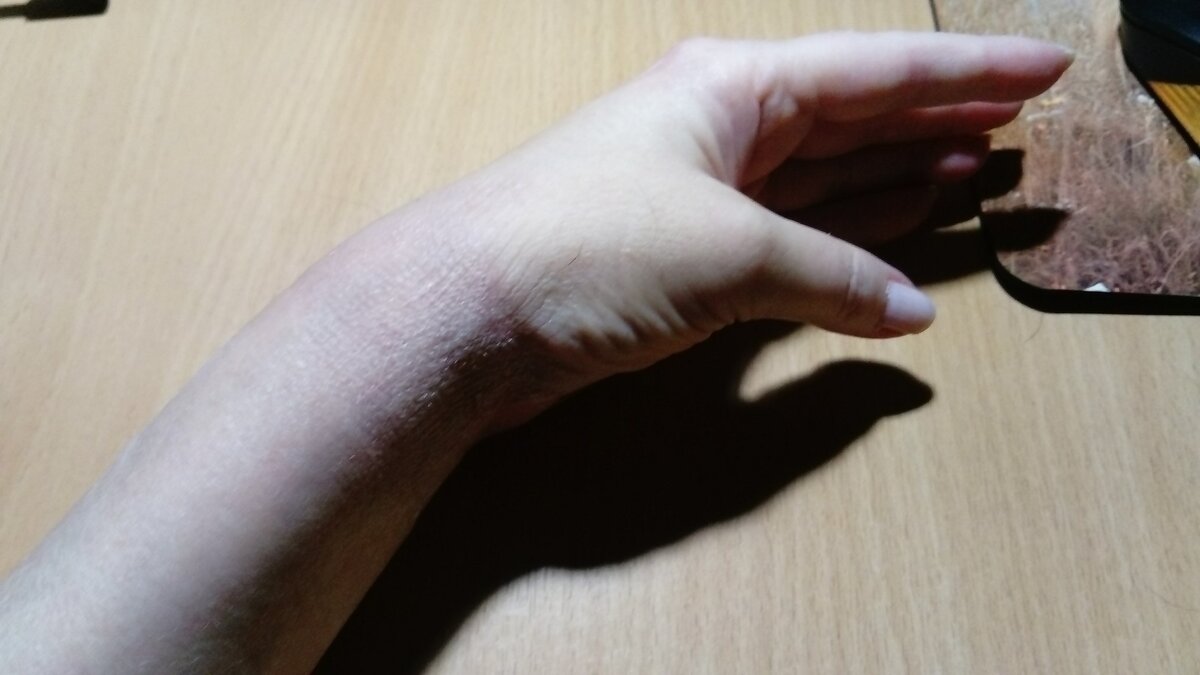 Вот она, моя «красавица», без гипса / все фотографии в тексте — автора