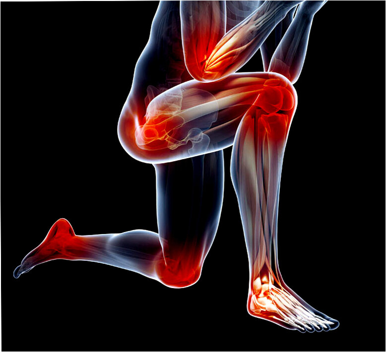 Суставы ног хруст в суставах. Боль в колене. Суставы ног хруст в суставах. Артрофлекс. Суставы ног хруст в суставах.