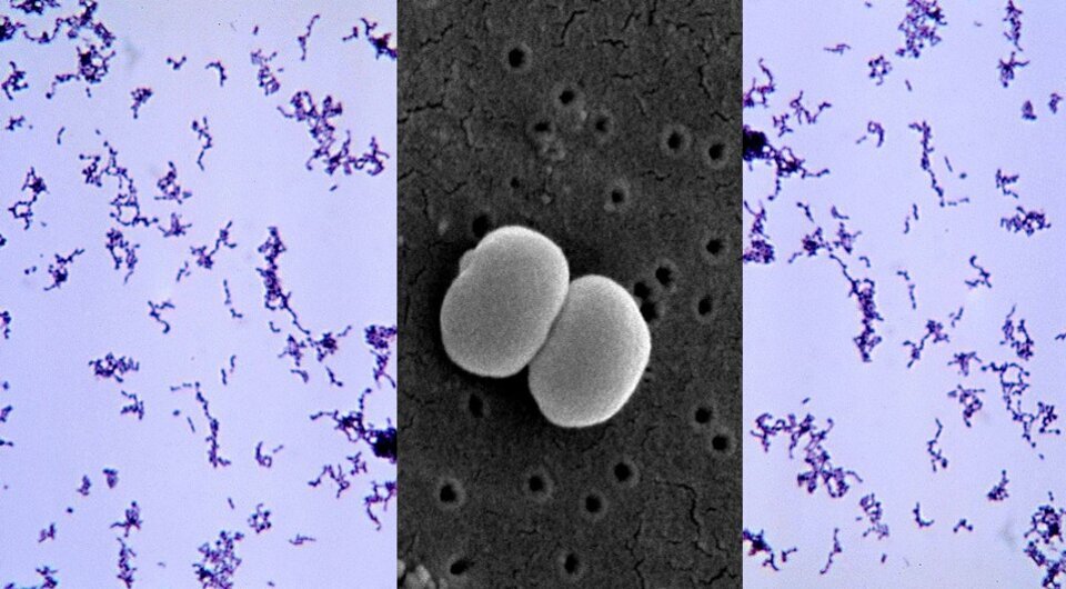   N + 1; Janice Carr / Wikimedia Commons / Public Domain; Bobby Strong / Wikimedia Commons / Public Domain