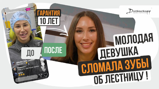 СЛОМАЛА ЗУБЫ об лестницу! → #имплантациязубов #зубныепротезы