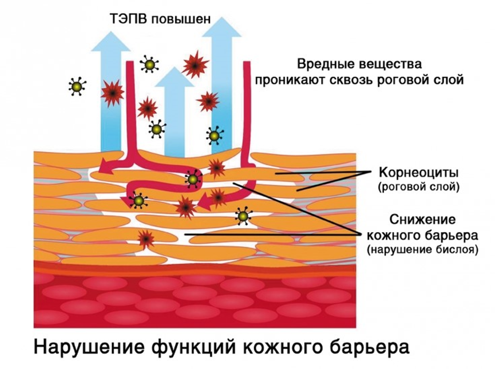 Восстановление барьера кожи. Гидролипидная мантия кожи липидный барьер роговой слой кожи. Эпидермальный барьер и гидролипидная мантия. Факторы, повреждающие липидный барьер кожи. Эпидермальный барьер липидная мантия.