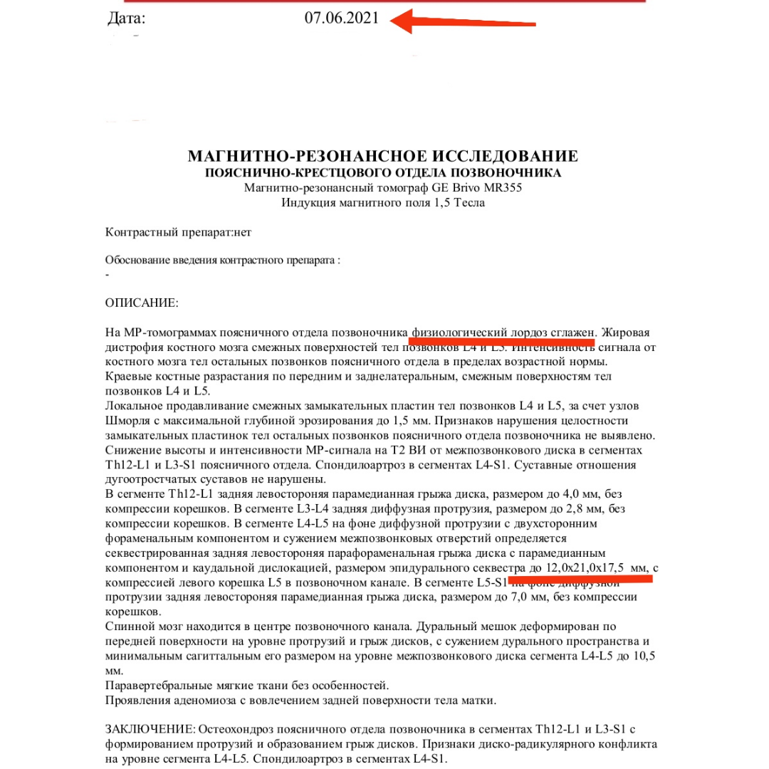 Результаты МРТ 2021 года