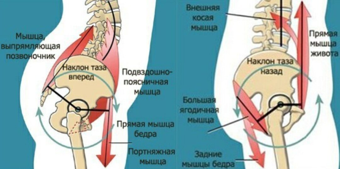 Подвздошно поясничная мышца бедра. Наклон таза. Передний наклон таза. Наклон таза вперед. Передний наклон таза мышцы.