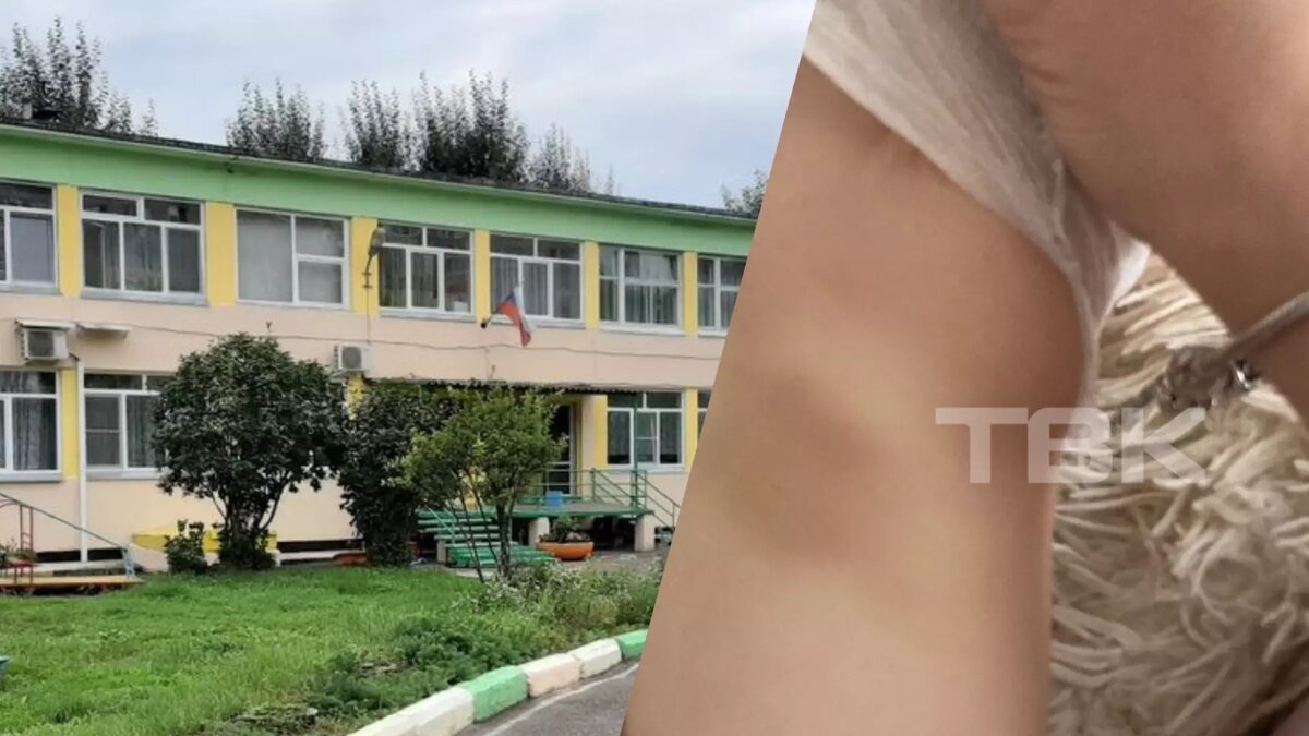     Об избиениях родители узнали по синякам не теле детей. Ситуацией заинтересовались правоохранительные органы.