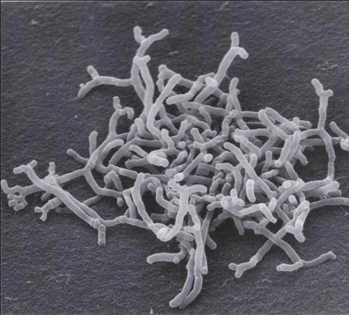 Иллюстрация: indiamart.com