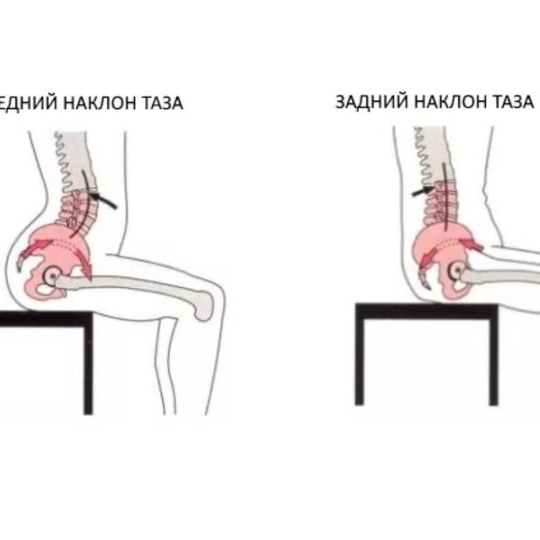 Почему низкое садится. Гиперлордоз наклон таза. Передний и задний наклон таза. Осанка наклон таза назад. Правильное положение таза.