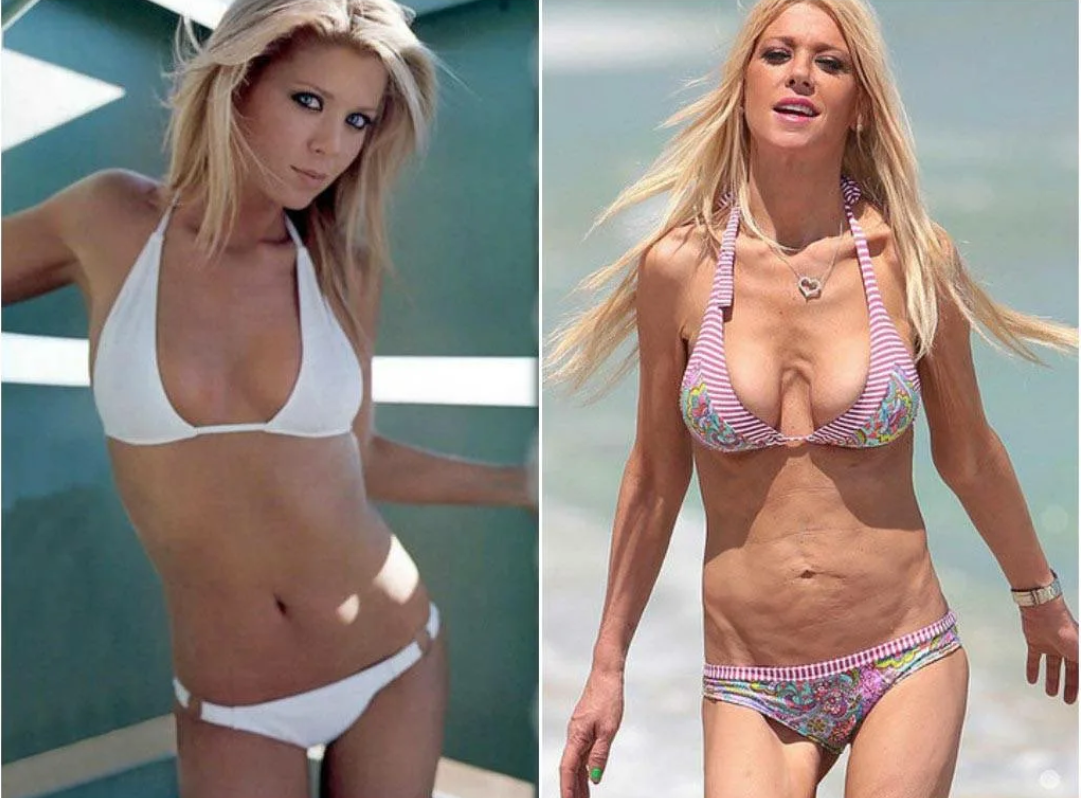 Силиконовая худая девушка. Тара Рид липосакция. Тара Рид до липосакции. Тара Рид пластика. Тара Рид грудь пластика