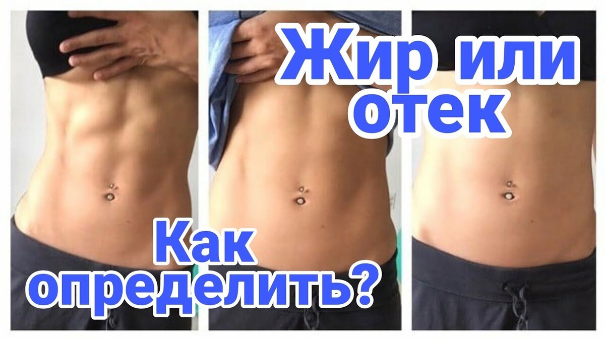 Как понять что отеки а не жир. Лимфостаз слоновая болезнь. Как понять что отеки а не жир. Как понять что отеки а не жир. Как понять что отеки а не жир.