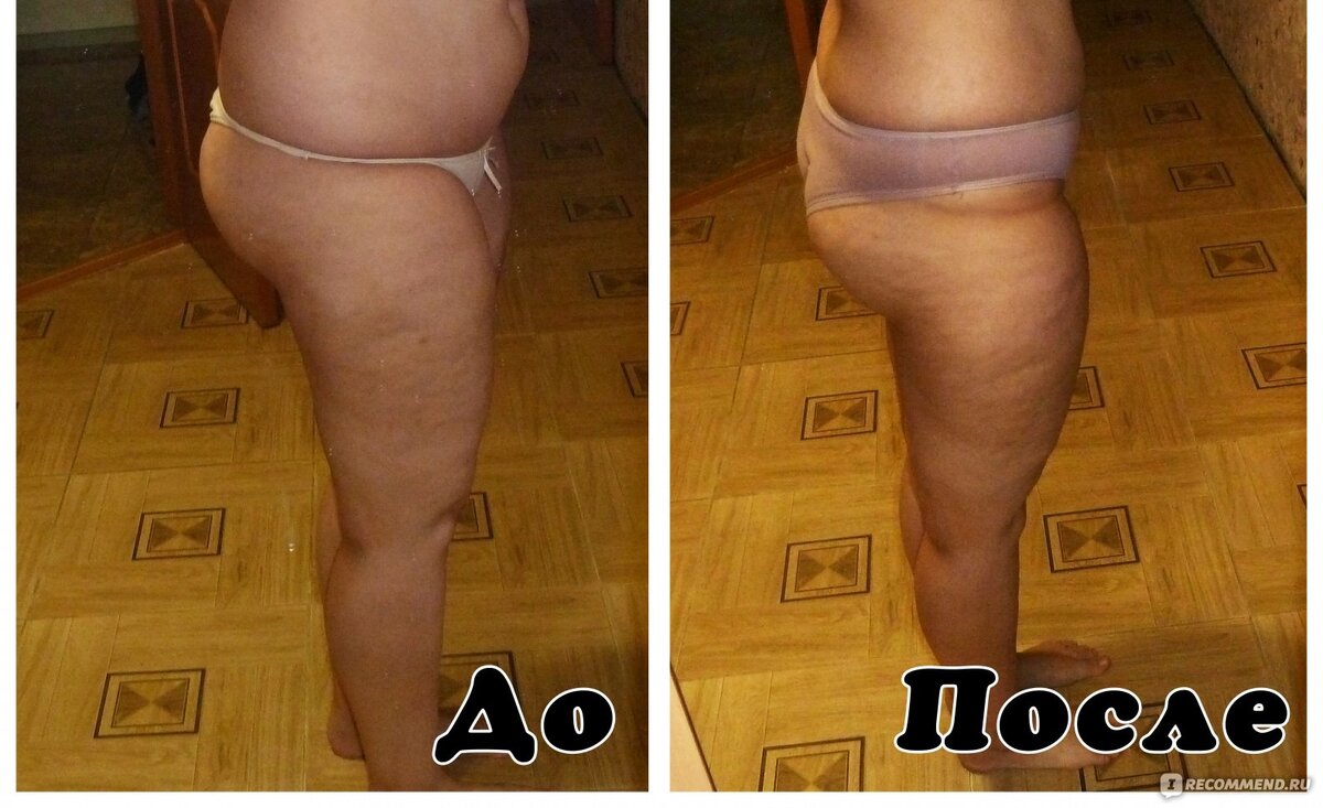 Как определить отёки у нас или Ожирение? | Худею и стройнею не спеша на ...